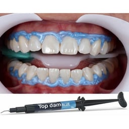 Top dam light-curing resin Gingival Dam, Blue, 4 x 2g Syringe & 3