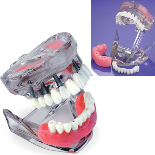 Denshine Dental Dentist Flesh Pink Gums Standard Teach Model Student Learning eB