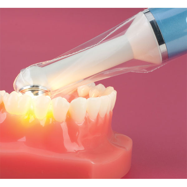 Fusion Disposable Barrier Sleeves 100/Pk. LED Curing Light