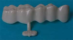 DirectCrown Bridge Posterior Bridge - Shells Only: 16 Posterior Bridge Shells Only (Opaque)