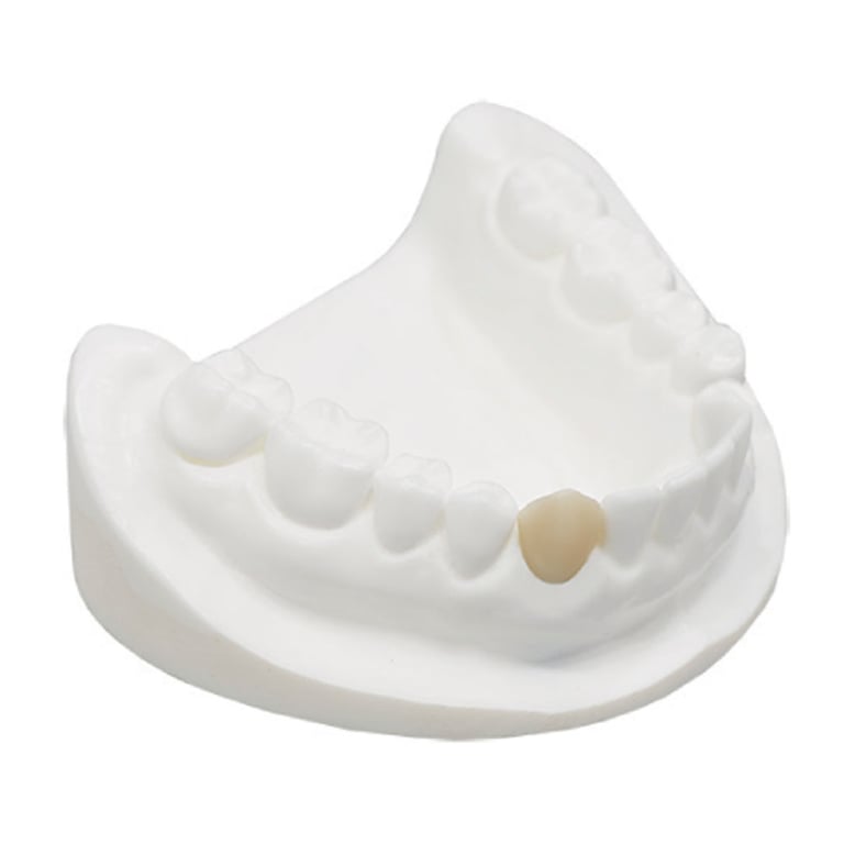 3D MAX-Crown Light-curing 3D Print Resin, A1, 1000 Gm. Bottle, 1/Pk. Designed for permanent crown