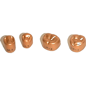 Temgold #1 Upper Left 1st Permanent Bicuspid Gold Anodized Aluminum Temporary Crowns, Box of 5
