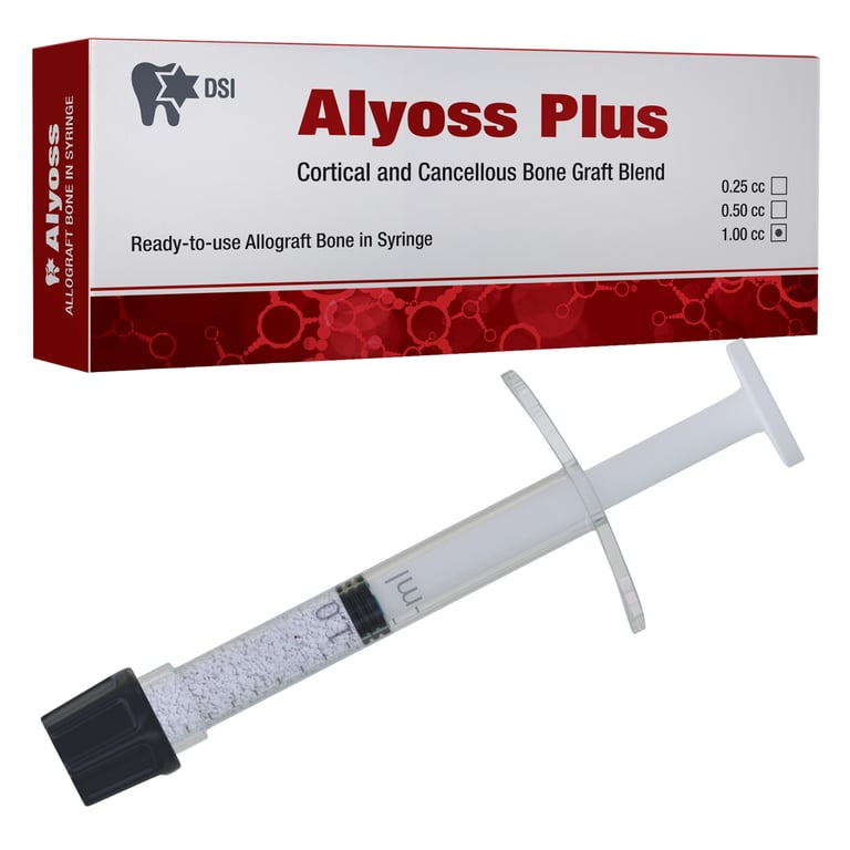 DSI Alyoss Plus Allograft Bone Graft, Cortical Cancellous, 0.50cc, 1/Pk. Pre-filled syringe