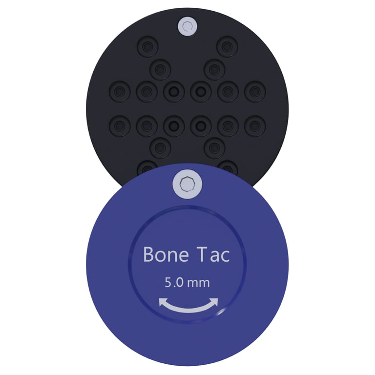 DSI GBR Stainless Steel Bone Tack Case, 5.0mm (Blue), 1/Pk. Utilizes a sliding top deck
