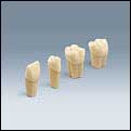 Frasaco Simulation Model Tooth for Restorative Pr