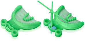 Harmony Anterior Dual Arch Bite Trays. Two Devices in One: Anterior Tray and Facial Plane Relator