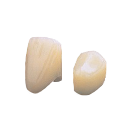 House Brand #2 Upper Right Lateral Polycarbonate Crown Form, Box of 5 Crown Forms