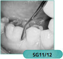 Hu-Friedy #11/12 double end Gracey curette with #4 handle