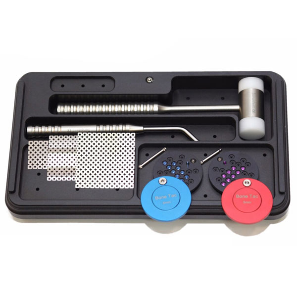 Next Implants Mesh Bone Tack Kit. Guided Bone Regeneration, a procedure that regenerates missing