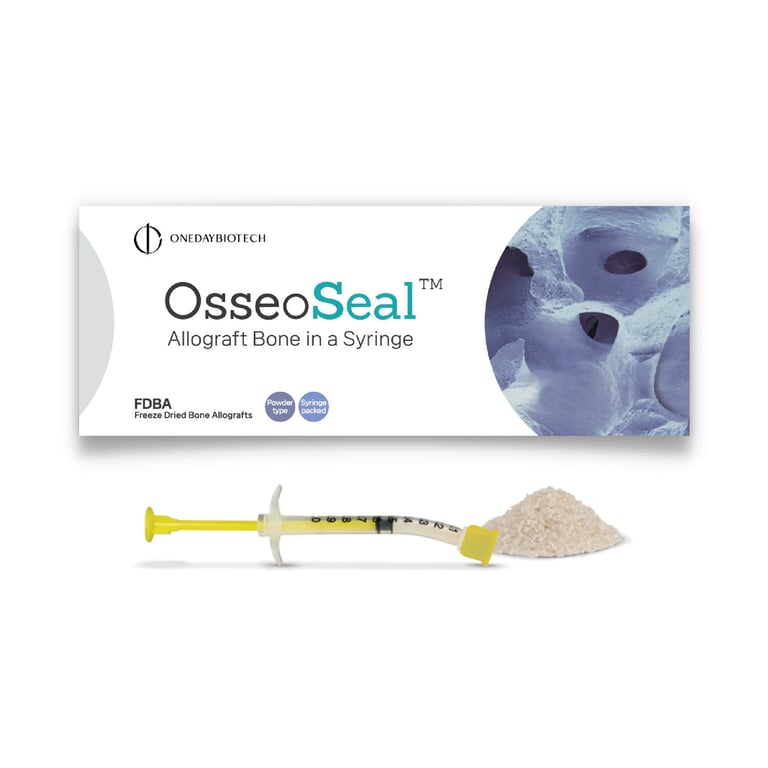 OsseoSeal Prefilled Bone in Syringe, 250-800 Microns, 0.3cc, 1/Pk. Mineralized cortico-cancellous