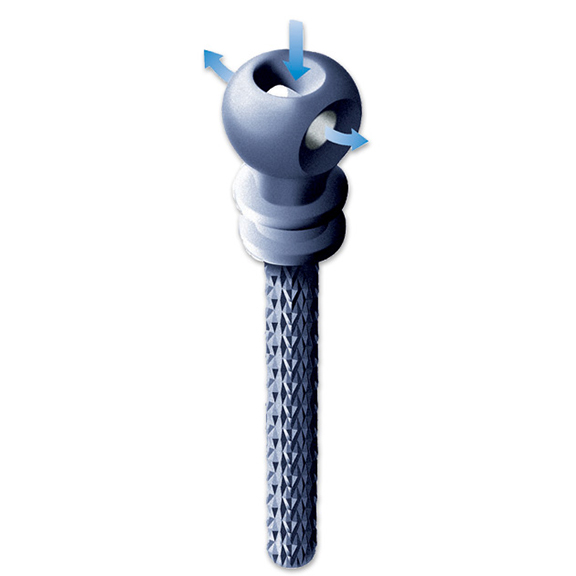 IntegraPost #4 Titanium Alloy Posts, Package of 10. #3001110