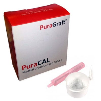 PuraCAL Calcium sulfate kit 1 gm. Medical grade calcium sulfate hemihydrate material for bone