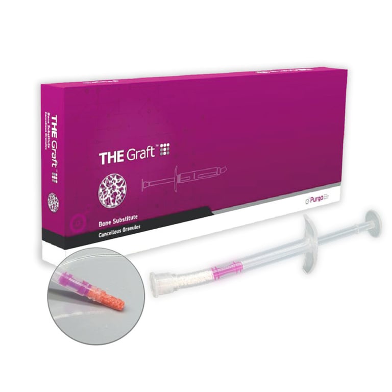 THE Graft Sterile Cancellous Granule, 0.25- 1.0mm, 1.0cc Syringe, 1/Pk. Natural, porous bone