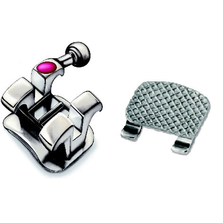 Gemini Unitek Brackets Kit, MBT, .022, U/L, 5x5, HKS, APC II, 20/Kit. Unitek Brackets offer