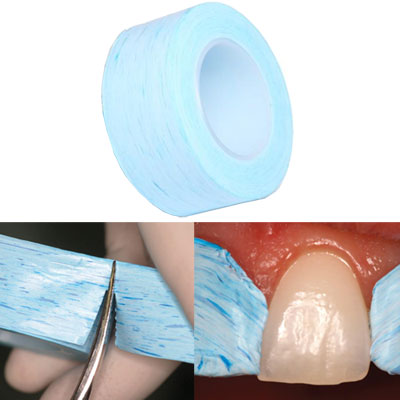 TDV IsoTape - 5 m of Tape for Dental Isolation. Indications: Isolation of adjacent teeth against