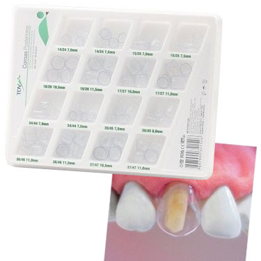 TDV Crowns Adults - 64 Transparent Crowns, Anterior. Adapt the crown by cutting its cervical