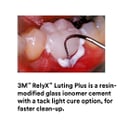 3M RelyX Luting Plus Clicker Trial Kit - Resin-Mo