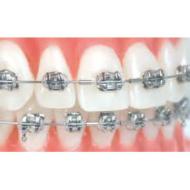 TOL 0.019 Mini Crimpable Stop 10/Bag. Typically p TOL 0.019 Mini Crimpable Stop 10/Bag. Typically p