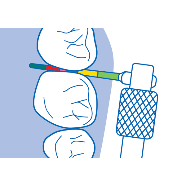 Curaprox IAP Probe - Interdental Access Probe Tips, 12/Pk. Measures ...