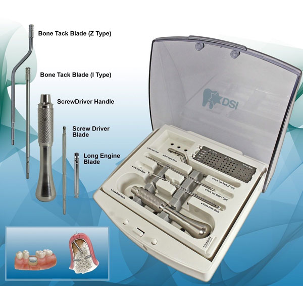 DSI Dental Implant Guided Bone Regeneration (GBR) Membrane Surgical