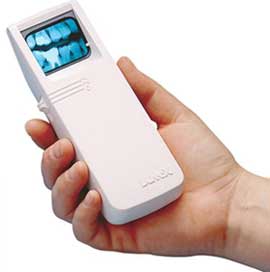 lum x white x ray viewer with a 32 mm x 41 mm viewable lum x white x ray viewer with a 32 mm x 41 mm viewable