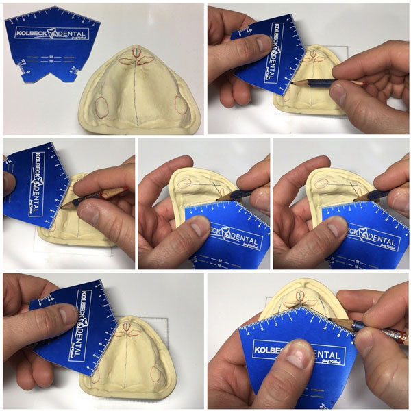 Occlusal Measurment Plate Occlusal Measurement Plane (OMP) for the