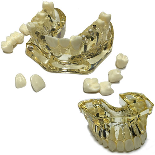 BesQual Implant Model, Oversize Upper. 5.00" x 4. BesQual Implant Model, Oversize Upper. 5.00" x 4.